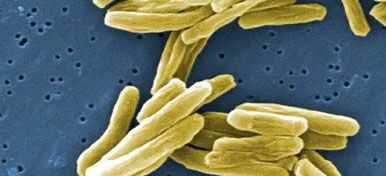 Microscopic view of Halophilic Bacteria